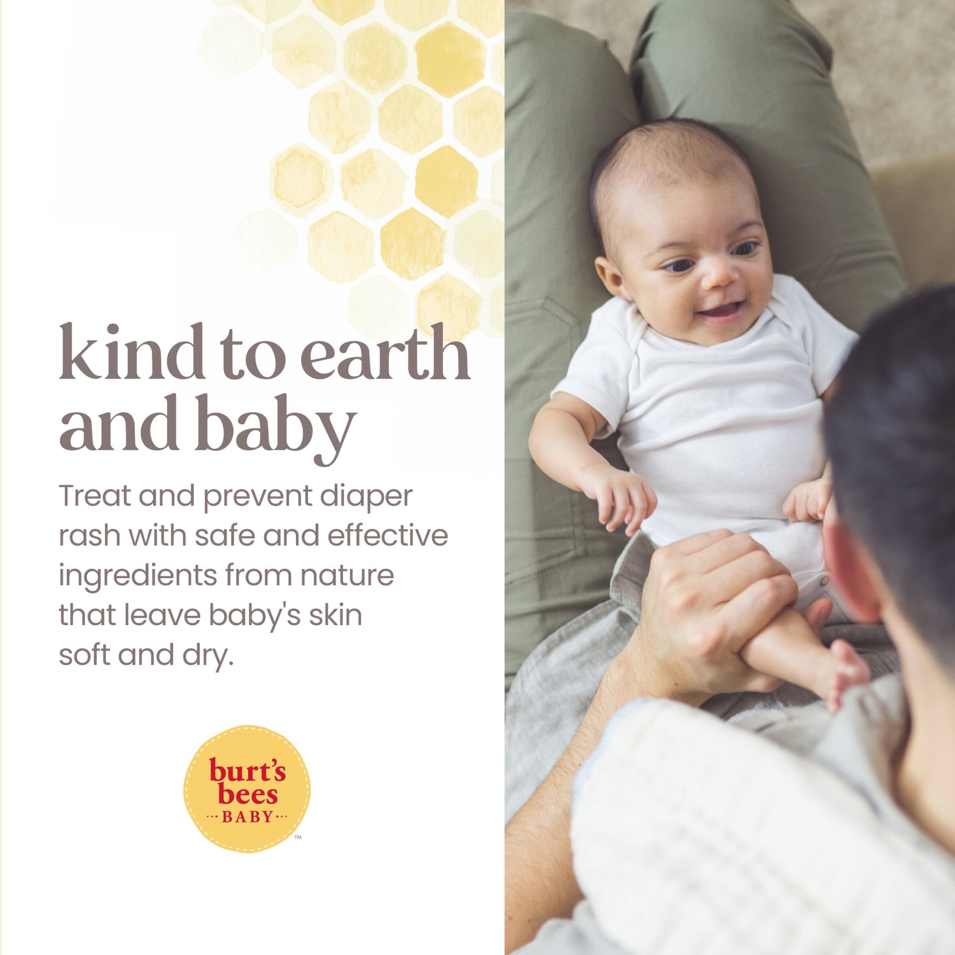 Burt's Bees Baby 100% Natural Origin Diaper Rash Ointment – Gentle, Natural Protection